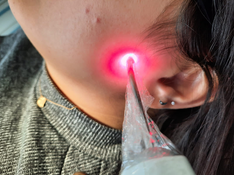 Foto 2 de Consultório de Laserterapia, Ozonioterapia e Auriculoterapia - CIELOTERAPIA
