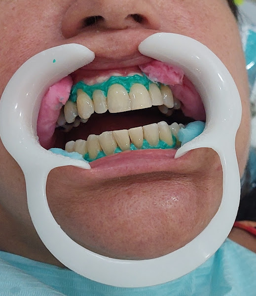 Foto 2 de Consultório Dentário