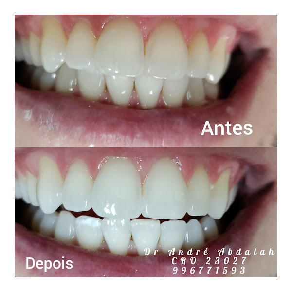 Foto 3 de Consultório Dentário Dr Abdalah