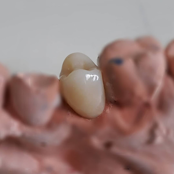 Foto 3 de Consultório Dentário Dr. Wellington Nicolau