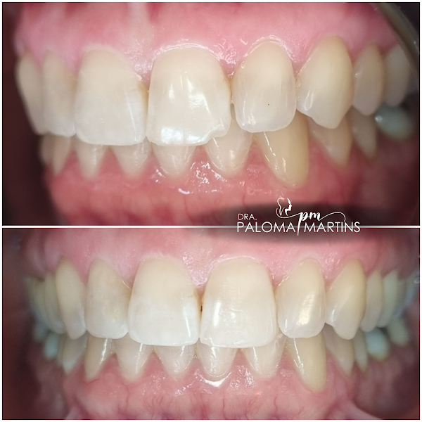 Foto 2 de Consultório dentário Dra Paloma Martins