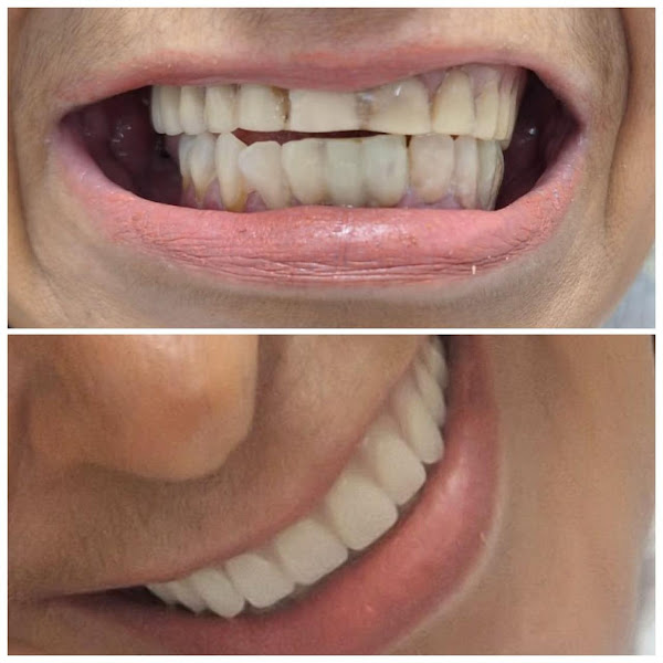 Foto 3 de Consultório Dentista Icaraí /Niterói/ Dra.Monica S. Lopes