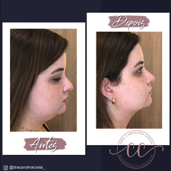 Foto 4 de Consultório Drª Carolina Costa