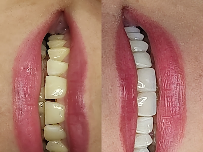 Foto 3 de Consultório Dra Âmina Freitas - Dentista Cacoal