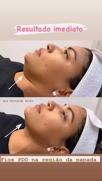 Foto 3 de Consultório Dra. Fernanda Rocha - Harmonização Facial e Endodontia