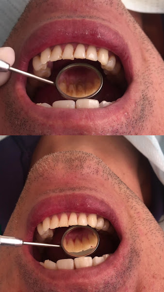Foto 3 de Consultório Dra. Janay Araújo - Cirurgiã Dentista