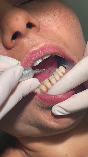 Foto 4 de Consultório Dra. Janay Araújo - Cirurgiã Dentista