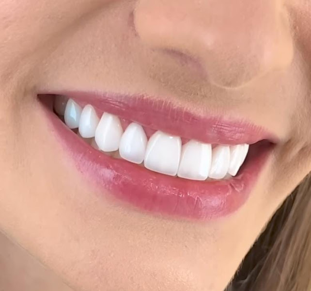 Foto 3 de Consultório Dra. Lis Leite - Clínica Odontológica Cirurgiã Dentista
