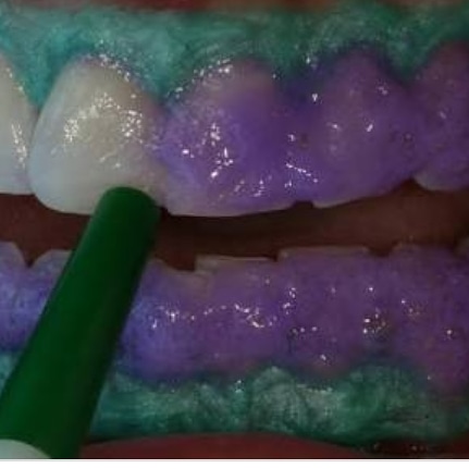 Foto 3 de Consultorio -Dra Luciana Queiroz / Cirurgia Dentista / Consultório Odontológico Dra Tatiana Ferreira