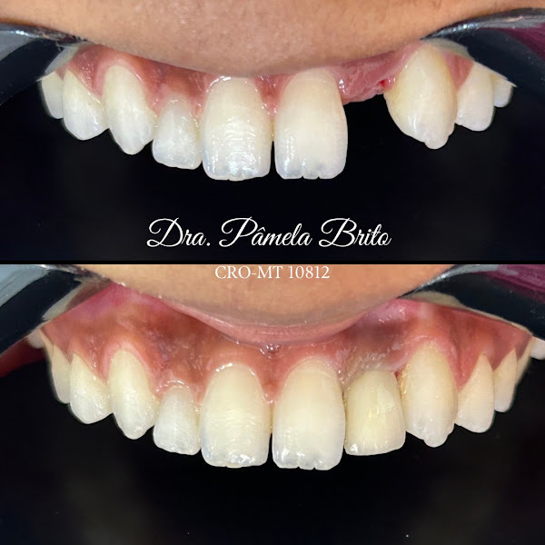 Foto 3 de Consultório Dra. Pâmela Brito DENTISTA 24horas EM SINOP