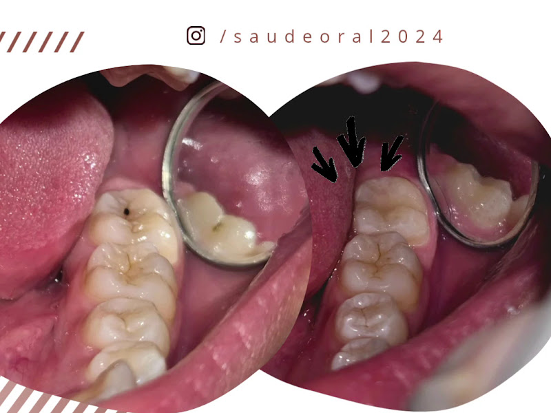 Foto 2 de Consultório Firmino odontologia Especializada