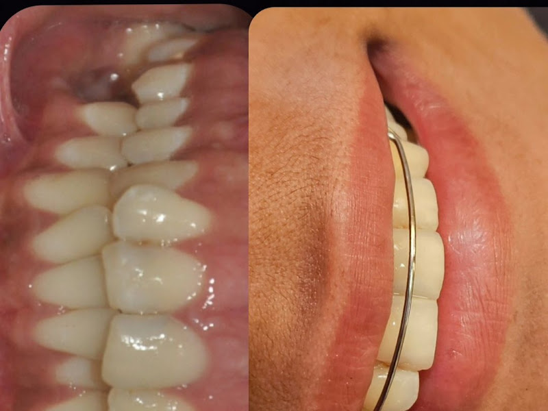 Foto de Consultório Hitala Siqueira - Dentista Jabotiana
