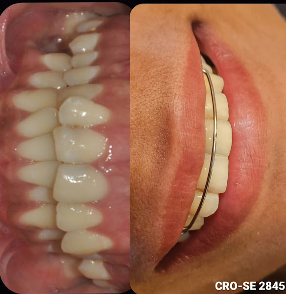Foto 2 de Consultório Hitala Siqueira - Dentista Jabotiana
