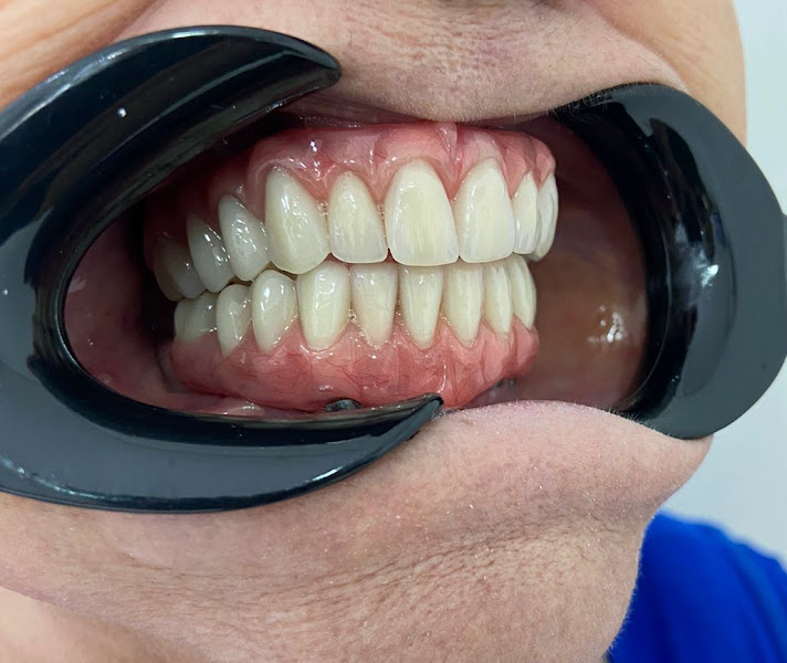 Foto 3 de Consultório Liberato Vieira - Odontologia em Praia Grande - Implantes Dentários | Lentes em Resina