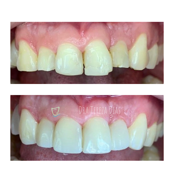 Foto 3 de Consultório Odonto Dra Tereza Dias