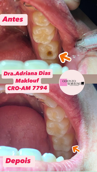 Foto 3 de Consultório Odonto Sorriso