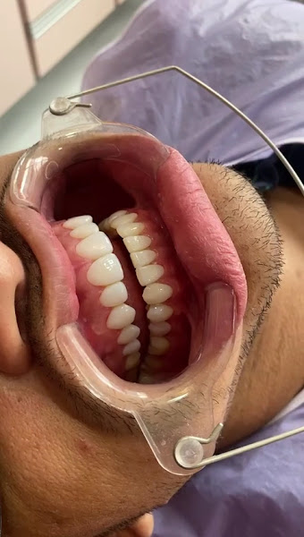 Foto 2 de Consultório Odonto Yasmim Feitosa