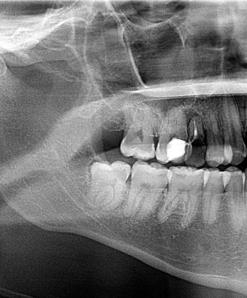 Foto 2 de Consultório Odontoleite Manaus