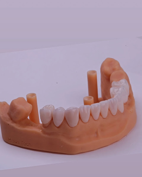 Foto 3 de Consultório Odontológico Andrei Rosa | Dentista em Cuiabá | Extração de sisos | Implante dentário | Prótese dentária