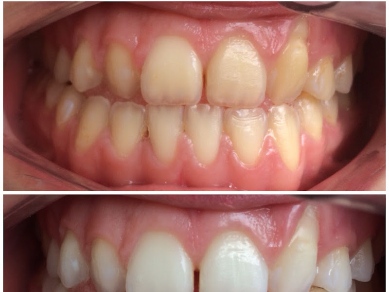 Foto 3 de Consultório Odontológico Bianca Teixeira Ribeiro