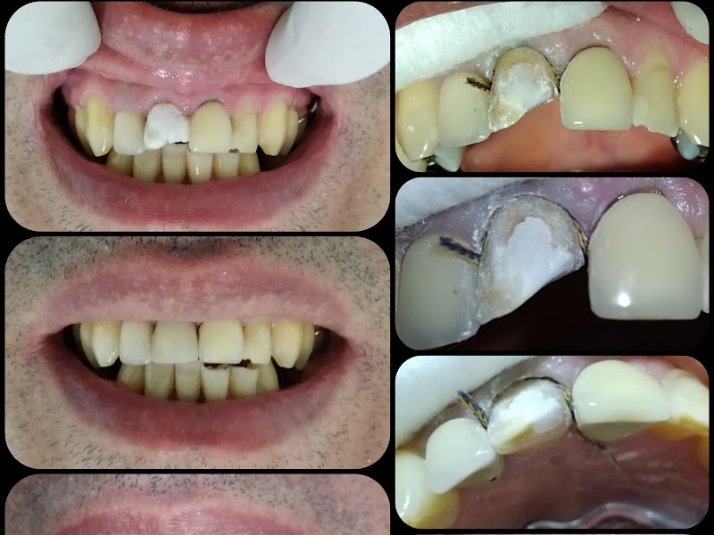 Foto 3 de Consultório Odontológico Clésio Corrêa Gonçalves e Maíra Henrique Gonçalves Cunha