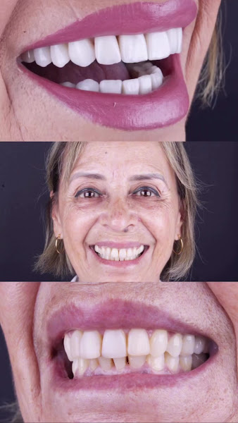 Foto 4 de Consultório Odontológico da Vila | Unid. 2 | Dentista na Vila Curuçá | São Miguel Paulista