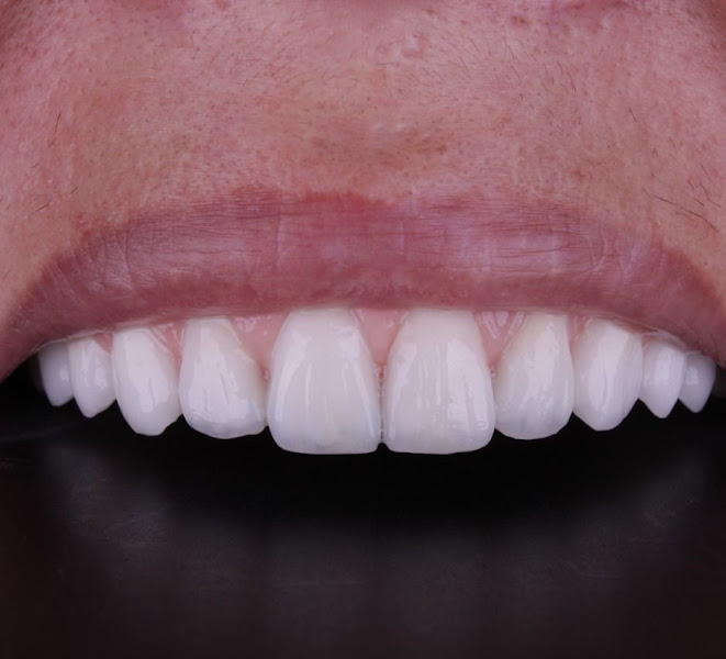 Foto 5 de Consultório Odontológico da Vila | Unid. 2 | Dentista na Vila Curuçá | São Miguel Paulista