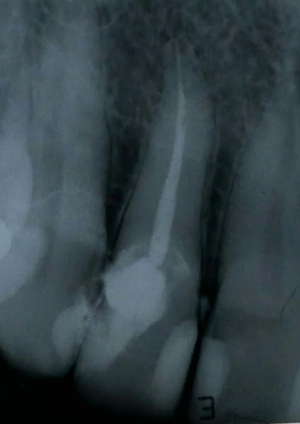 Foto 3 de Consultorio Odontologico de Endodontia