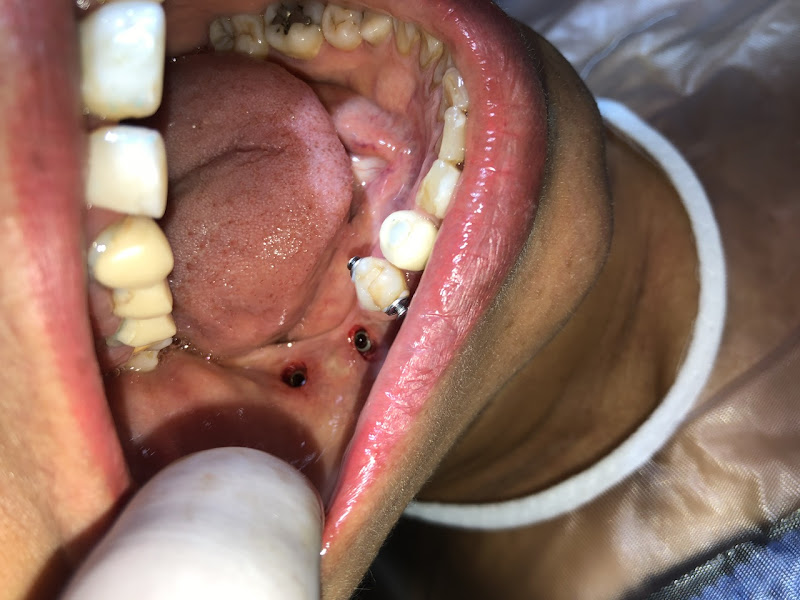 Foto 3 de Consultório Odontológico de Fabiano Oliveira Filho