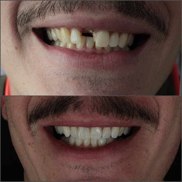 Foto 3 de Consultório Odontológico Dente de Leão