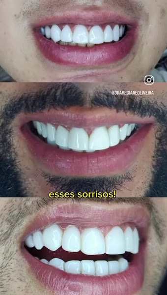 Foto 3 de Consultório odontológico Dentista Dra Regiane Oliveira Facetas Dentárias Ferraz de Vasconcelos