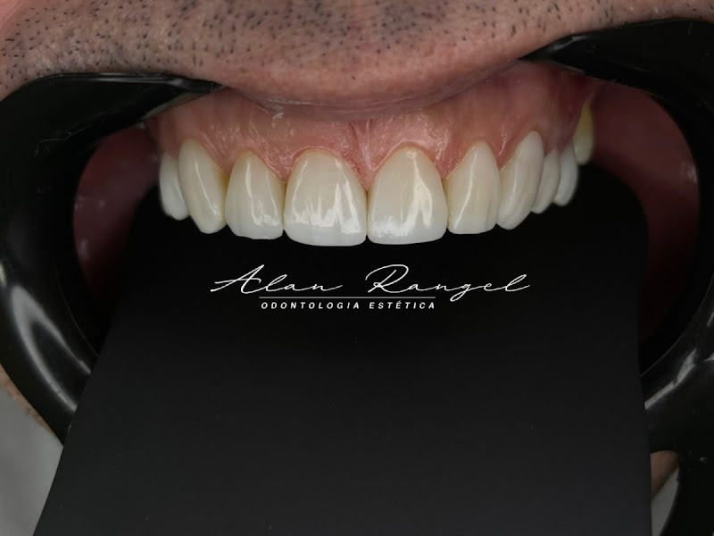 Foto 6 de Consultório Odontológico - Dr. Adler G. Laino