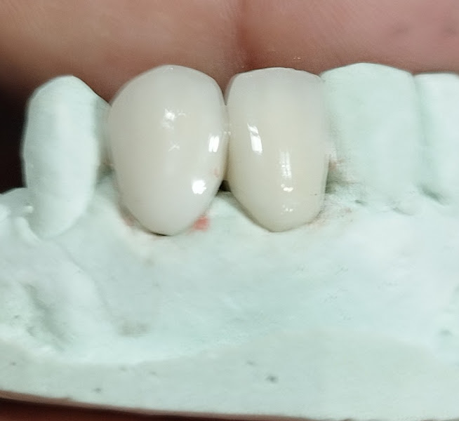 Foto 3 de Consultório Odontológico Dr. Alexandre Brolin Mazini