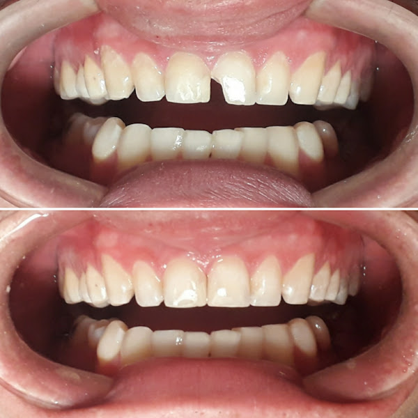 Foto 2 de Consultório Odontologico DR Allan Moterani