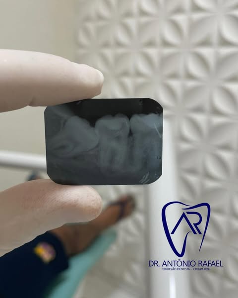 Foto 6 de Consultório Odontológico Dr. Antônio Rafael | Implante Dentário | Facetas | Clareamento Dental | Ananindeua