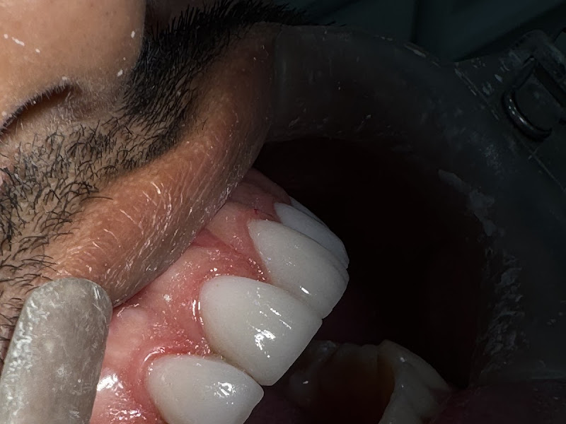 Foto 10 de Consultório Odontológico Dr. Antônio Rafael | Implante Dentário | Facetas | Clareamento Dental | Ananindeua