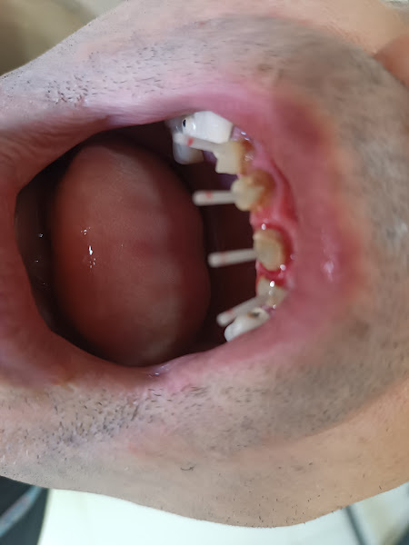 Foto 2 de Consultório Odontológico Dr. Bráulio Alvarenga e Dr. Marcos André Alvarenga