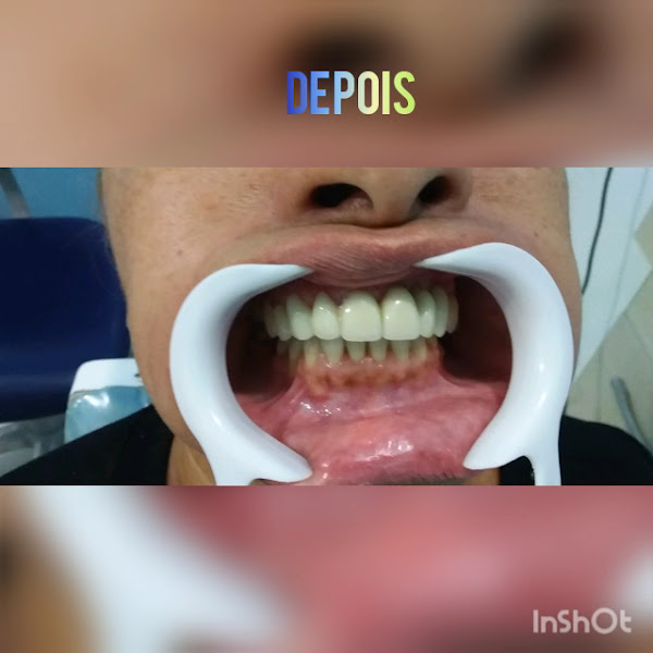 Foto 3 de Consultório Odontológico Dr. Bruno Carlos