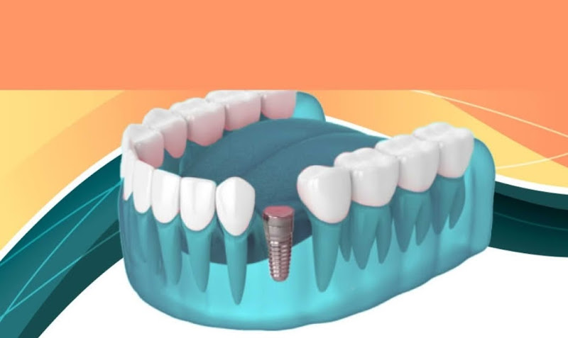 Foto 3 de Consultório Odontológico Dr.cristiano Gustavo / Cirurgião Dentista