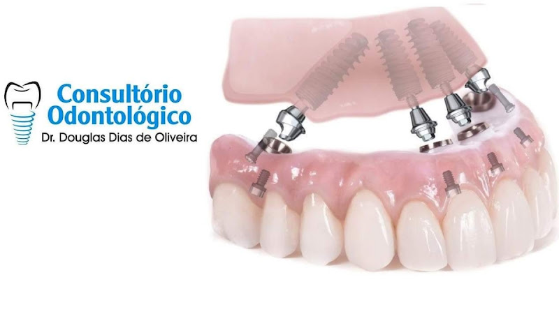 Foto 2 de Consultório Odontológico Dr. Douglas Dias de Oliveira