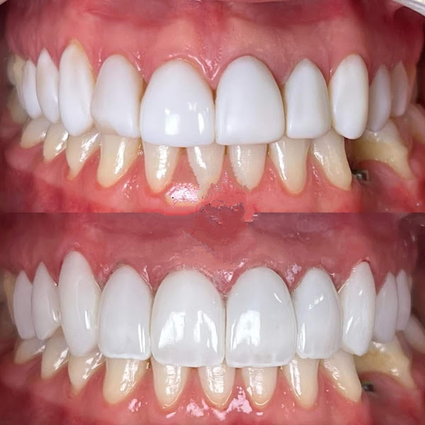 Foto 3 de Consultório Odontológico Dr.Eduardo Siervuli