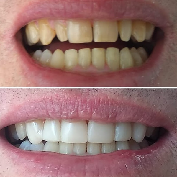 Foto 3 de Consultório Odontológico Dr. Evandro Crepaldi