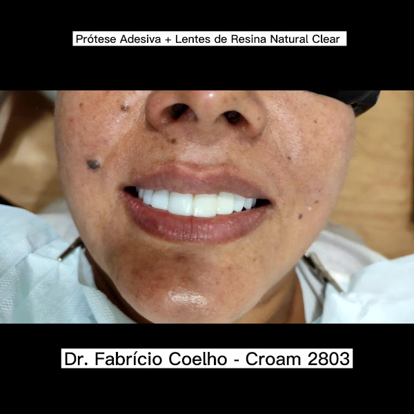 Foto 3 de Consultório Odontológico Dr.Fabrício Coêlho