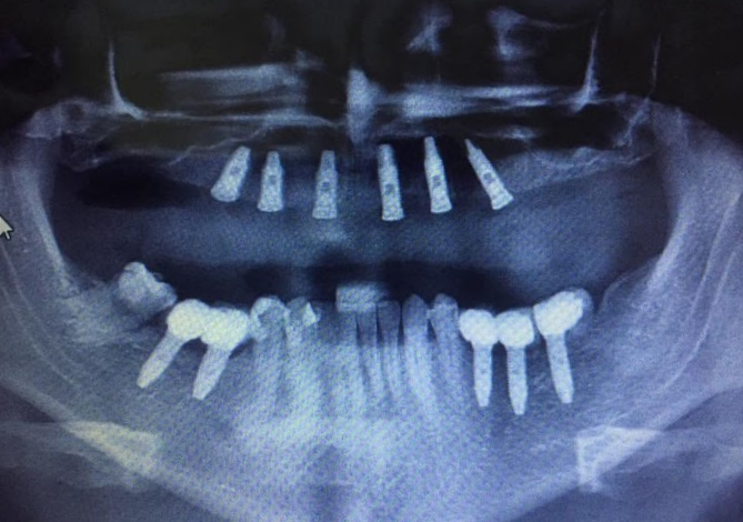 Foto 3 de CONSULTÓRIO ODONTOLÓGICO DR. FABRÍCIO SCHWAN