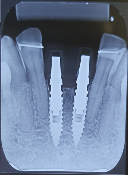 Foto 3 de Consultório Odontológico Dr. Hadonys Dutra