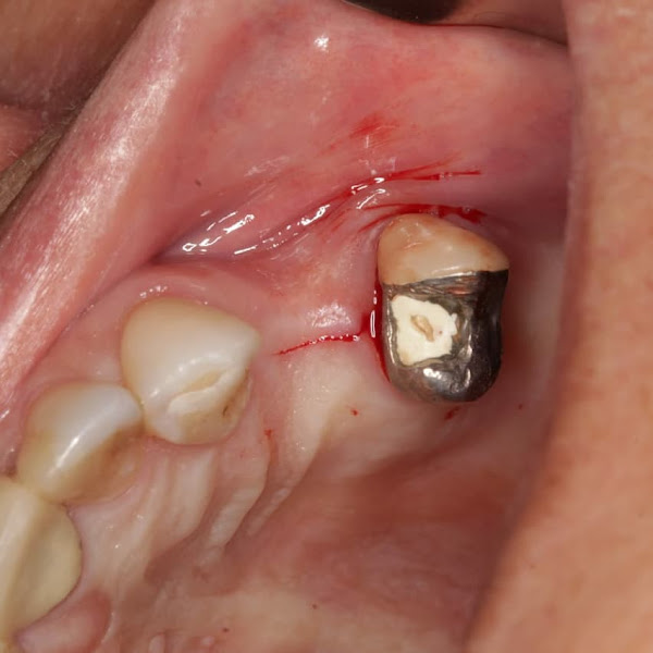 Foto 3 de Consultório Odontológico Dr Klauston Guimaraes