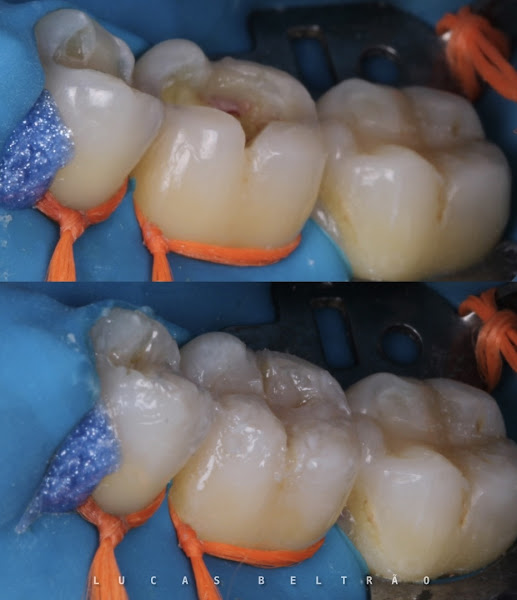 Foto 2 de Consultório Odontológico- Dr. Lucas Beltrão