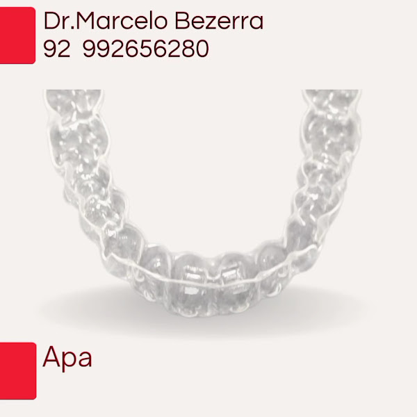 Foto 4 de Consultório Odontológico Dr. Marcelo de Souza Bezerra implantes ,odontologia domiciliar aparelhos ortodonticos