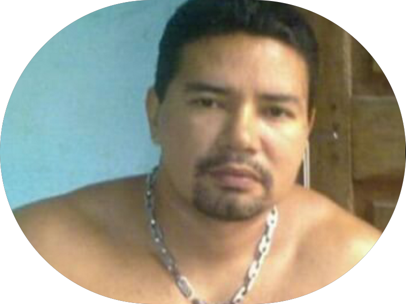 Foto 6 de Consultório Odontológico Dr. Marcelo de Souza Bezerra implantes ,odontologia domiciliar aparelhos ortodonticos