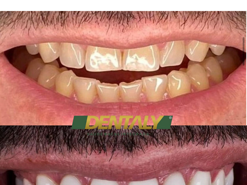 Foto 9 de Consultório Odontológico Dr. Marcelo de Souza Bezerra implantes ,odontologia domiciliar aparelhos ortodonticos